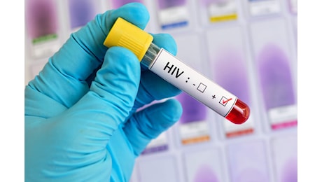 Casi di HIV in crescita: il ritorno ai dati pre-pandemia