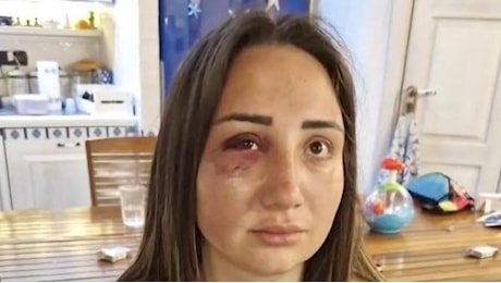Pozzuoli, Gaia massacrata di botte dall'ex: in un video lui la picchia tenendo in braccio il loro bambino