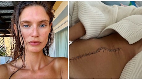 Bianca Balti, la cicatrice dopo il tumore (e l'operazione). «La foto più coraggiosa»: tra pochi giorni inizia la chemio