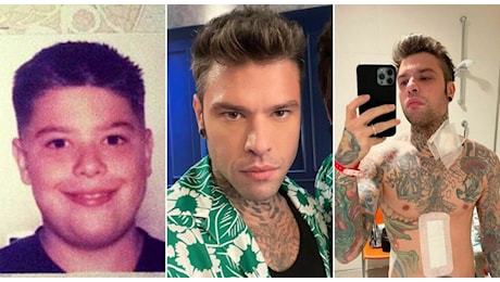 Fedez, chi è? Oggi compie 35 anni: le origini, la malattia, Chiara Ferragni, il dissing, l'inchiesta ultras