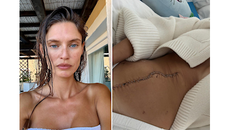 Bianca Balti, inizia la chemio: Coraggio a chi sta come me